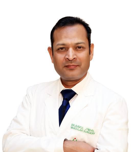 Best Vascular Surgeon In Mohali, Chandigarh
