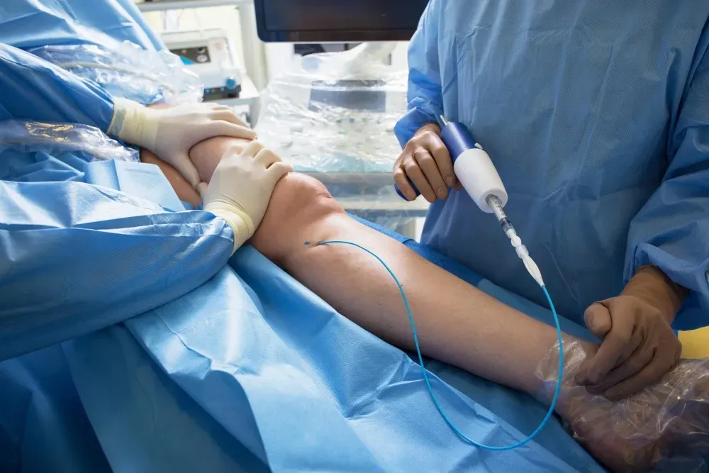 VenaSeal Treatment in Mohali - Glue Therapy for Varicose Veins